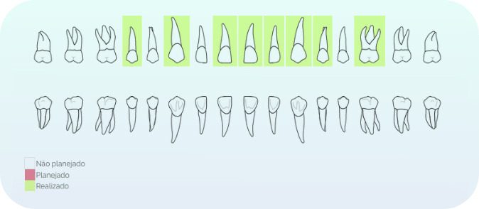 Odontograma digital: Uma ferramenta importante para o cirurgião-dentista